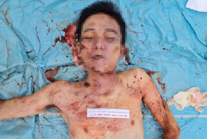  Người đàn ông tử vong dưới chân cầu Cần Thơ: Sáng 2/10, người dân phát hiện người đàn ông tử vong dưới chân cầu Cần Thơ thuộc xã Mỹ Hòa, thị xã Bình Minh. Cảnh sát đã khám nghiệm, nạn nhân khoảng 30-35 tuổi, có chiều cao 1,63 m và chưa rõ danh tính. Trên người mặc quần lửng vải jean màu xanh, áo thun cổ tròn màu xám. Cảnh sát thông báo ai có thân nhân với đặc điểm nêu trên đề nghị liên hệ Phòng Cảnh sát hình sự, theo số điện thoại 0270.387.7177. 