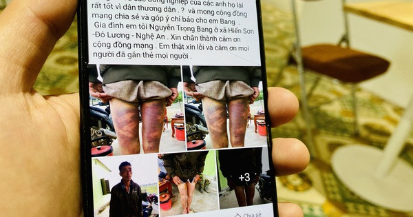 Đến ngày 18/5, hội đồng kỷ luật Phòng tổ chức cán bộ Công an tỉnh Nghệ An họp đưa ra hình thức kỷ luật, theo đó, ông Phạm Văn Ngọc - Công an xã Hiến Sơn - bị kỷ luật cảnh cáo, điều chuyển đến công tác tại Công an xã Ngọc Sơn, huyện Đô Lương sau vụ việc. 