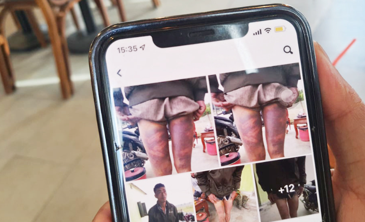 Theo tố cáo, tối 10/1, sau khi nhận thông tin anh Nguyễn Trọng Bang (37 tuổi) đến nhà mẹ vợ cũ thăm con trong tình trạng uống rượu và có quấy rối, gây ồn ào, hai cán bộ công an viên và Công an xã Hiến Sơn, huyện Đô Lương đến cưỡng chế, còng tay đưa anh Bang về trụ sở công an xã. Do bức xúc về hành vi chửi bới, thách thức và dùng gậy chống lại lực lượng thi hành công vụ nên ông Ngọc và ông Quân đã dùng gậy cao su (công cụ hỗ trợ cấp cho công an xã) đánh vào mông, đùi và chân anh Bang. Hậu quả, anh Bang bị nhiều vết thương bầm tụ máu ở vùng đùi, cẳng chân. 