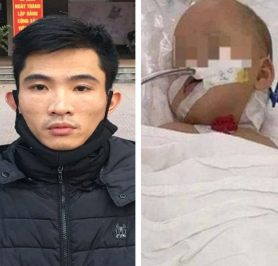 Chiều cùng ngày, thấy cháu Ánh có biểu hiện buồn nôn, sức khỏe yếu, không đứng vững, Huyên cùng chị Luyến gọi xe taxi đưa đến Bệnh viện đa khoa huyện Thạch Thất cấp cứu trong tình trạng hôn mê, co giật toàn thân, vùng đầu có nhiều vết xước, sờ có dị vật dưới da, chảy dịch tai hai bên.