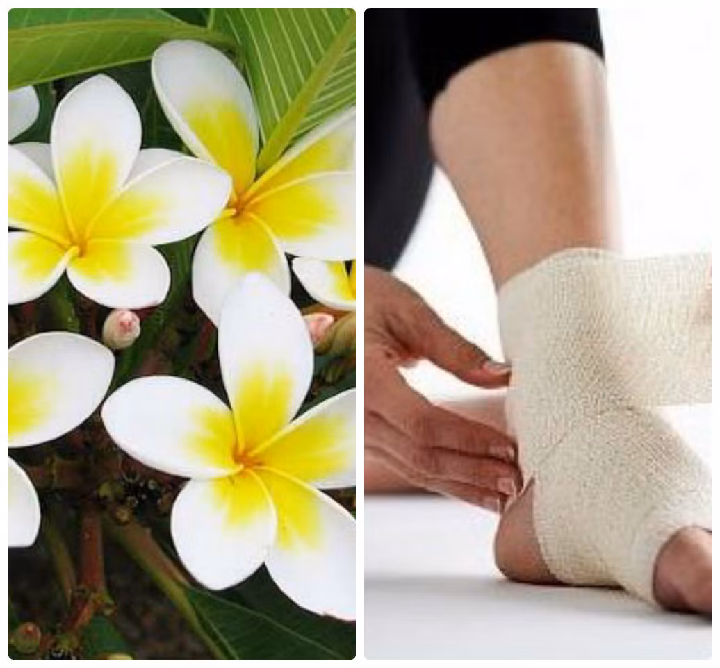 Dân gian còn sử dụng hoa đại để chữa bong gân. Lấy lá hoa đại tươi rửa sạch, giã nát, trộn với một ít muối ăn rồi đắp lên chỗ sưng. Dùng một lá tươi khác hơ lên lửa cho héo, đắp phía ngoài rồi cố định bằng vải sạch. Ngày đắp 1 - 3 lần.