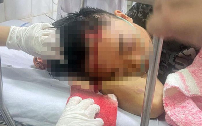 Hải Phòng: 40 thanh thiếu niên hỗn chiến náo loạn vùng quê Hai Phong: 40 thanh thieu nien hon chien nao loan vung que