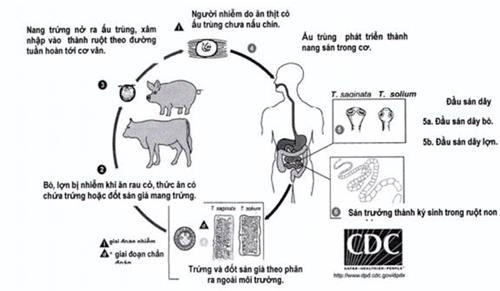 Nguy co nhiem san tu mon goi thit trau, bo song