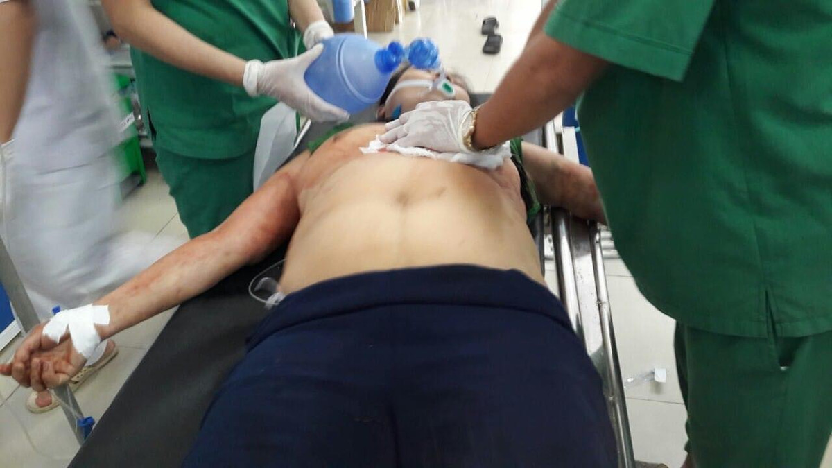 Hai vo chong bi truy sat, vo chet, chong nguy kich o Ha Tinh