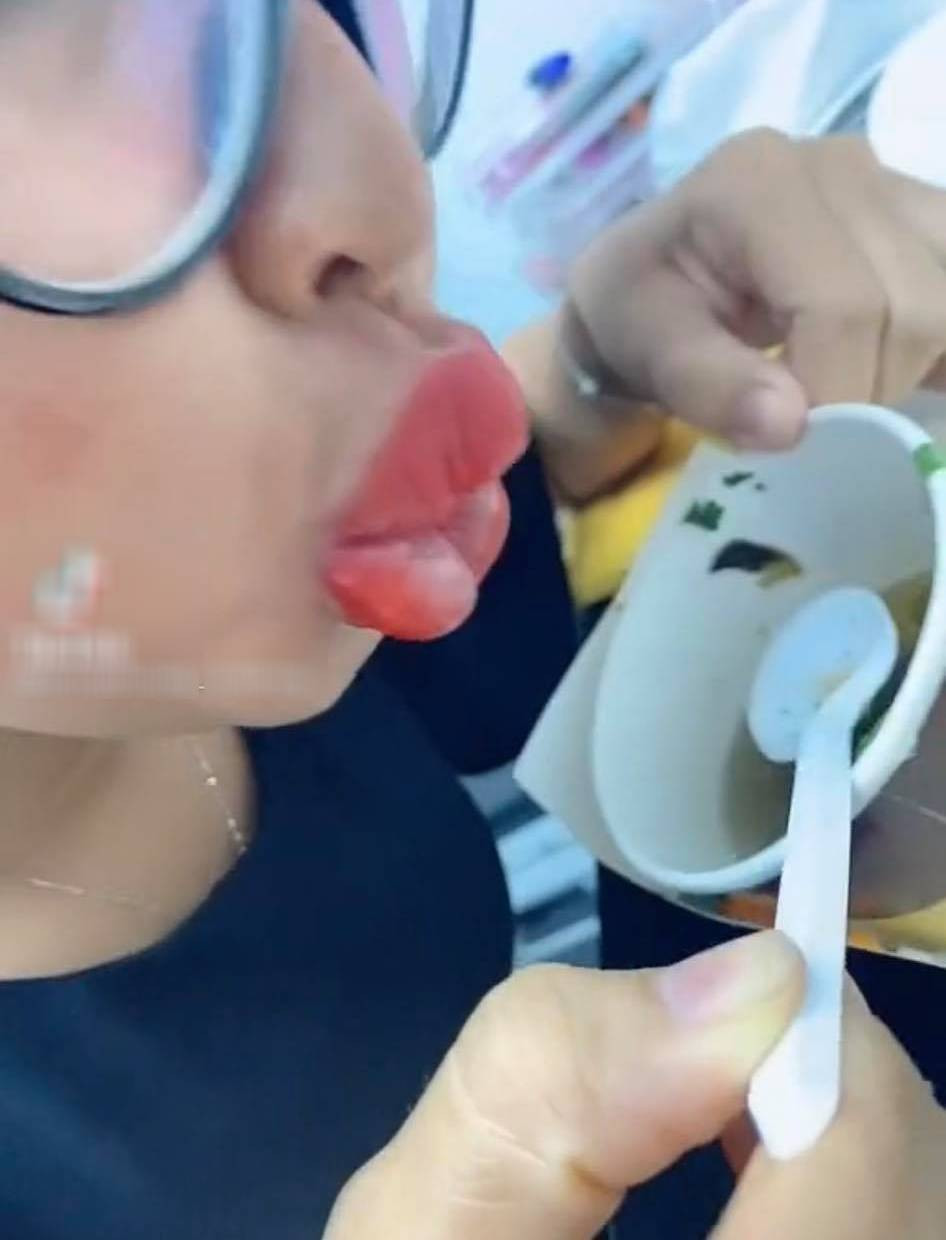 Tuy nhiên cách làm đẹp này không phải lúc nào cũng hoàn hảo, nếu tin tưởng vào cơ sở thẩm mỹ kém chất lượng thì hoàn toàn có thể cho ra đời loạt thảm họa.