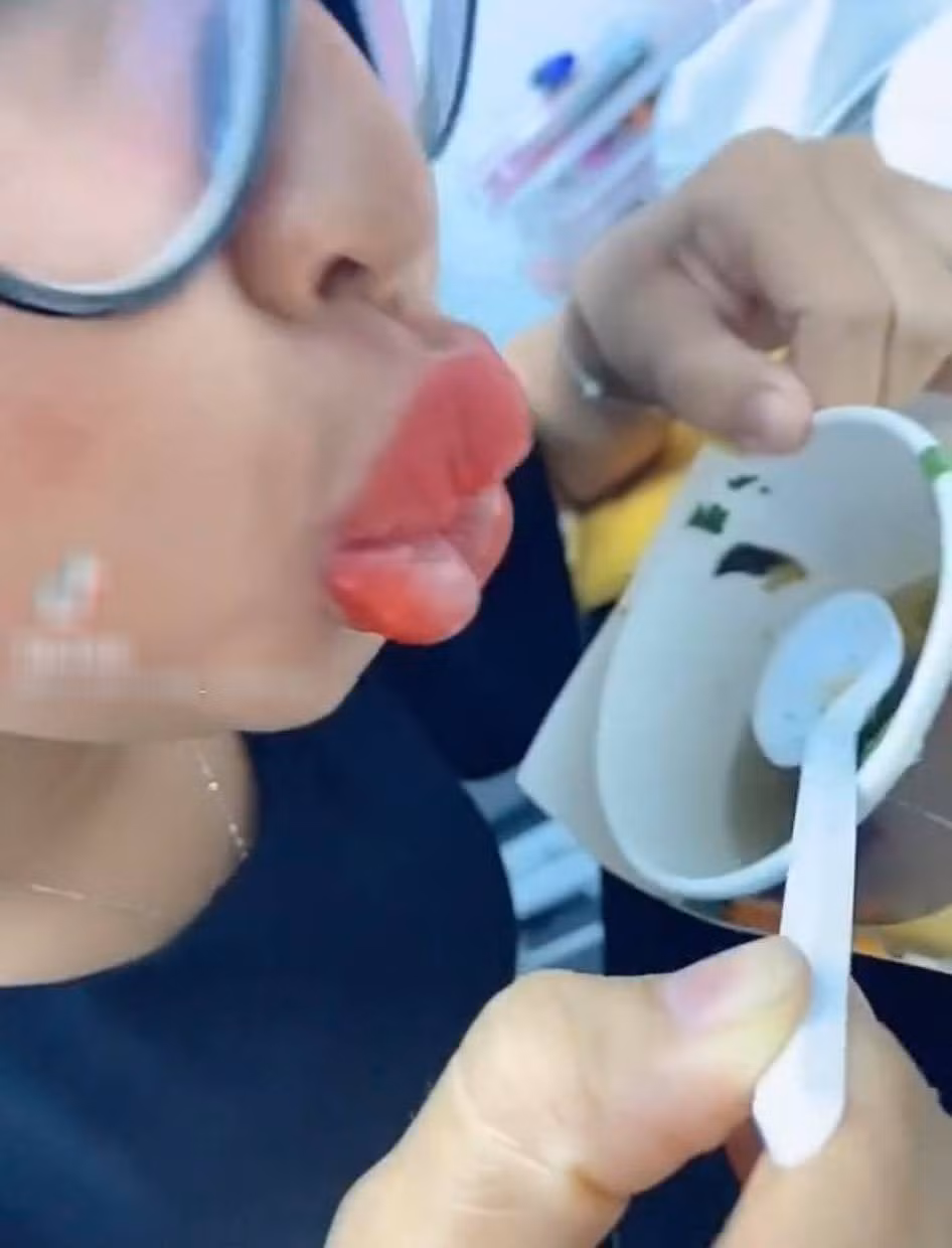 Tuy nhiên cách làm đẹp này không phải lúc nào cũng hoàn hảo, nếu tin tưởng vào cơ sở thẩm mỹ kém chất lượng thì hoàn toàn có thể cho ra đời loạt thảm họa.