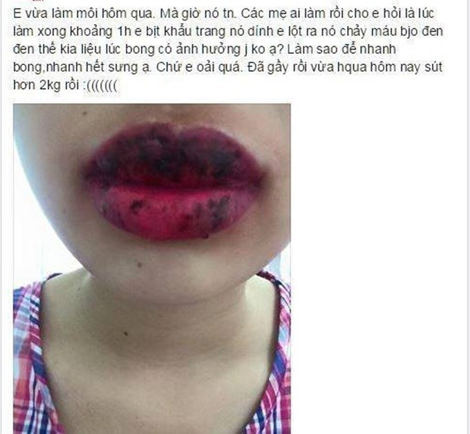 Nhiều người phải tới bệnh viện, mất rất nhiều thời gian và tiền bạc mới có thể trở về đôi môi bình thường trước khi xăm.