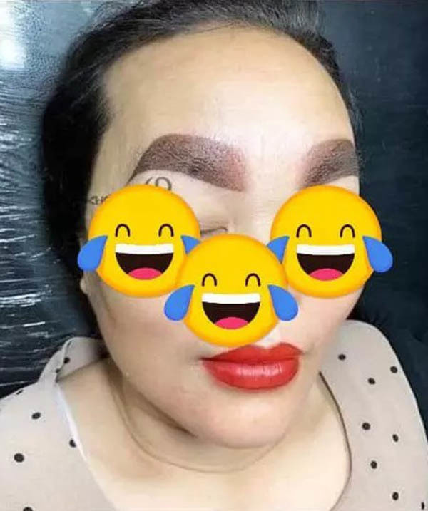 Nipapron đã tìm đến 3 địa chỉ khác nhau để xóa hình xăm nhưng chúng cũng chỉ mờ đi ít nhiều chứ không hề biến mất.