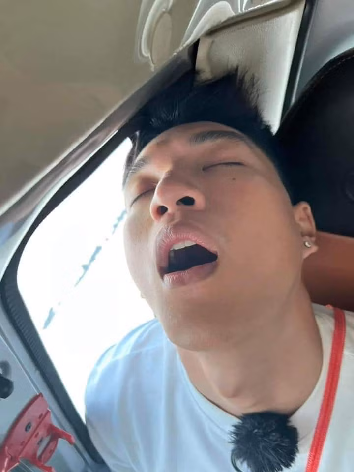 Vô tình ngủ quên một chút thôi đã có ngay bức ảnh xấu xí để đời.