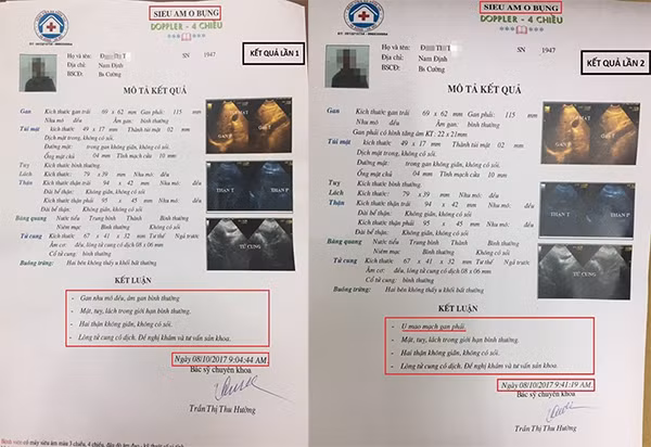 So Y te HN noi gi ve chuyen lum xum o benh vien da khoa 16A Ha Dong-Hinh-2