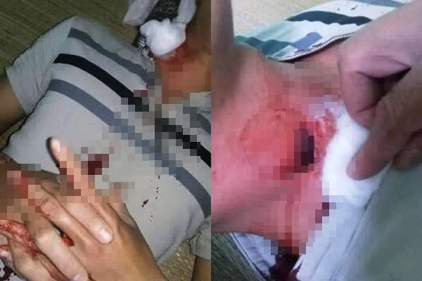 Mo lay di vat nghi la "dan lac" chui tot vao co thanh nien