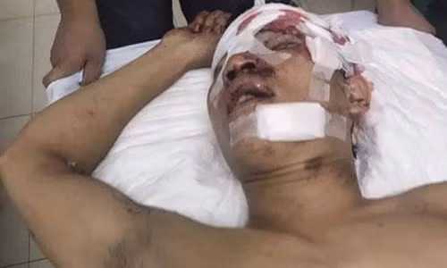 10 ten con do truy sat kinh hoang 2 thanh nien o Ha Noi-Hinh-2