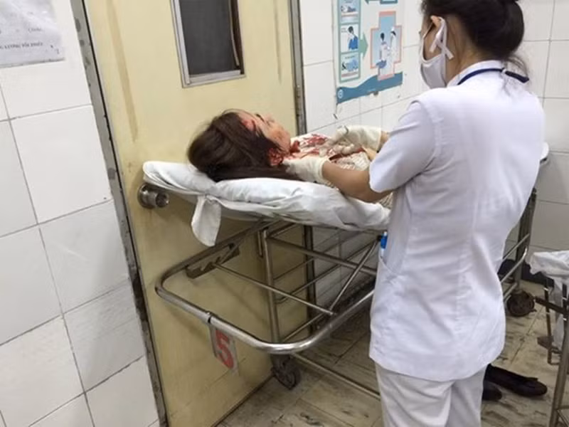 Một thanh niên đi đường đã kịp thời đưa Ái Châu vào bệnh viện cấp cứu. Đầu của nữ diễn viên chảy máu khá nhiều, phải khâu một đường dài.