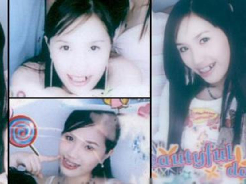 Lớn lên, Bảo Thy sở hữu hàm răng khấp khểnh. Sau đó nhờ niềng răng, nữ ca sĩ đã lột xác. Ảnh: Zing