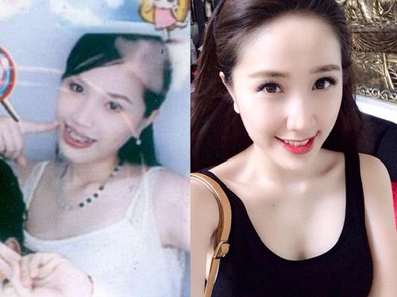 Bảo Thy từng vướng nghi vấn độn cằm. Tuy nhiên, "công chúa bong bóng" khẳng định cô không hề can thiệp "dao kéo". Ảnh: Vietnamnet