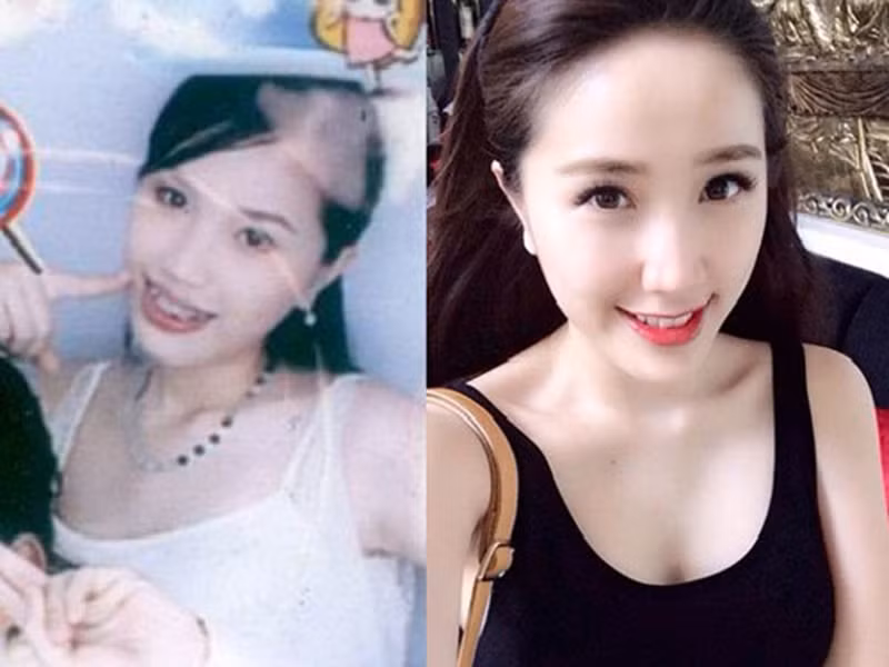 Bảo Thy từng vướng nghi vấn độn cằm. Tuy nhiên, "công chúa bong bóng" khẳng định cô không hề can thiệp "dao kéo". Ảnh: Vietnamnet