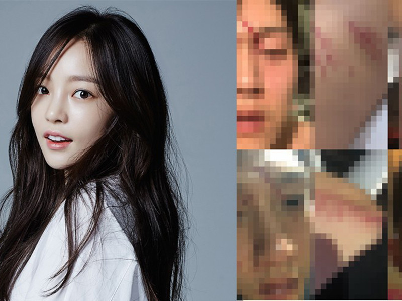 Khi lớn lên, Goo Hara chịu nỗi đau cả về thể chất lẫn tinh thần vì yêu nhầm người.