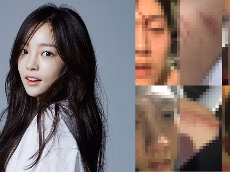 Khi lớn lên, Goo Hara chịu nỗi đau cả về thể chất lẫn tinh thần vì yêu nhầm người.