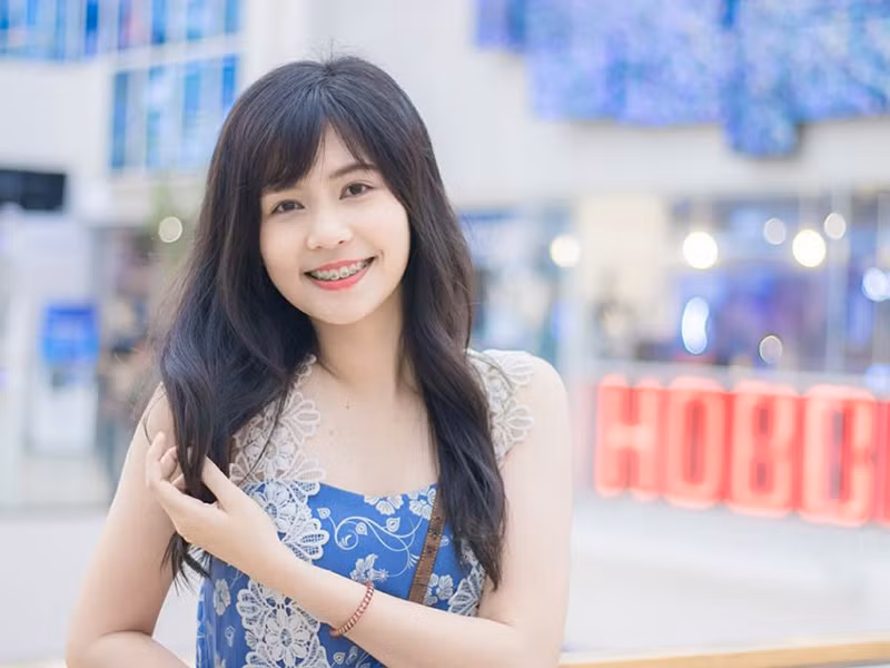 Tân hoa hậu thời niềng răng sở hữu nhan sắc ngọt ngào.