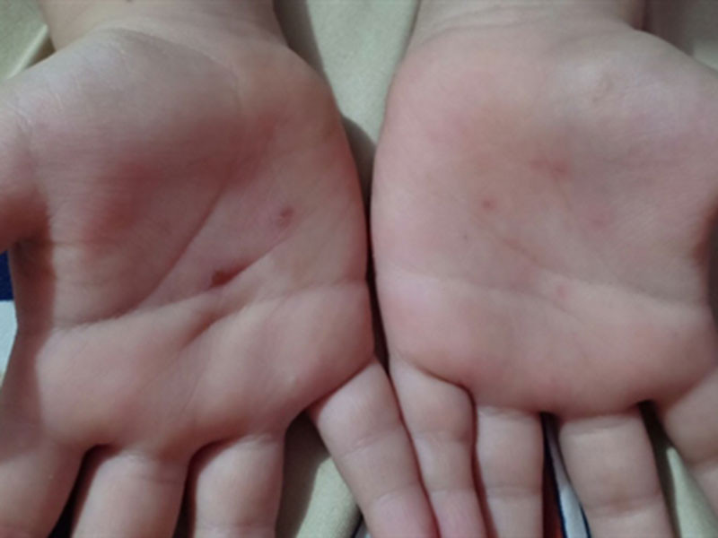 Co giao mam non bi to dung vat nhon dam vao tay be trai 5 tuoi