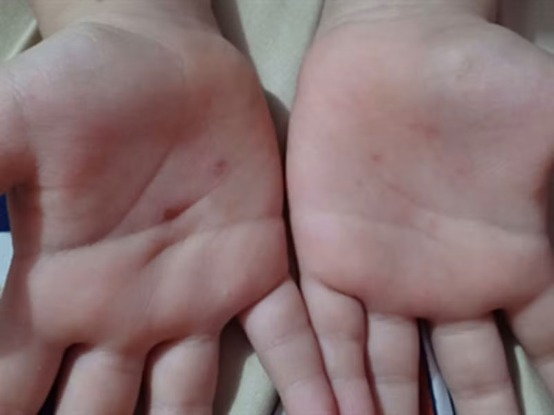 Co giao mam non bi to dung vat nhon dam vao tay be trai 5 tuoi