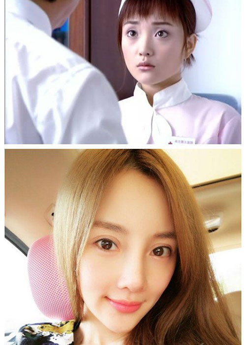 Lý Tiểu Lộ hiện bị ghét nhất trong showbiz Hoa ngữ. Ngoài scandal ngoại tình dẫn đến ly hôn, cô còn vướng lùm xùm dao kéo.