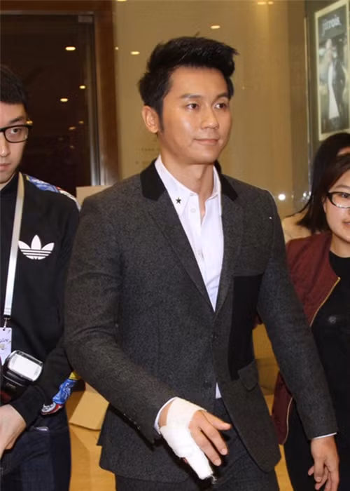 Lý Thần từng phải khâu 9 mũi, trật khớp tay, gãy ngón tay khi quay một chương trình truyền hình thực tế.