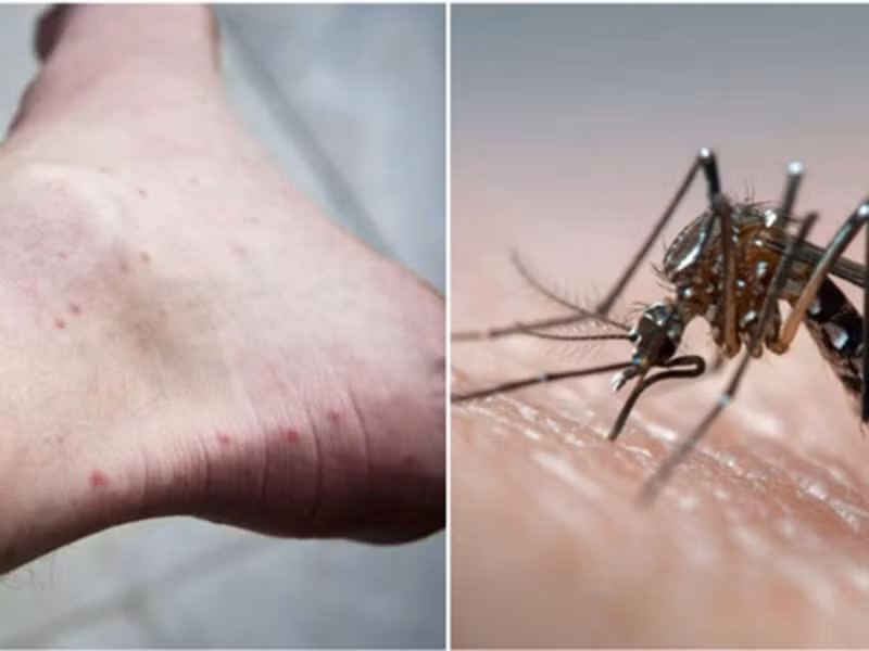 Nóng sốc: Bệnh sốt xuất huyết có thể lây qua đường tình dục Nong soc: Benh sot xuat huyet co the lay qua duong tinh duc