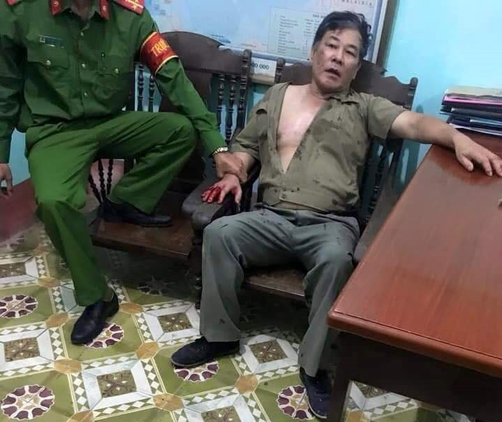  Anh trai sát hại gia đình em gái ở Thái Nguyên vì 3 tỷ: Khoảng 18h30 ngày 14/9, Bùi Xuân Hồng (SN 1956, trú tại phường Thịnh Đán, TP Thái Nguyên) mang theo dao nhọn đến nhà bà Bùi Thị Hà, ở tổ 14, phường Chùa Hang tiếp tục đòi nợ.