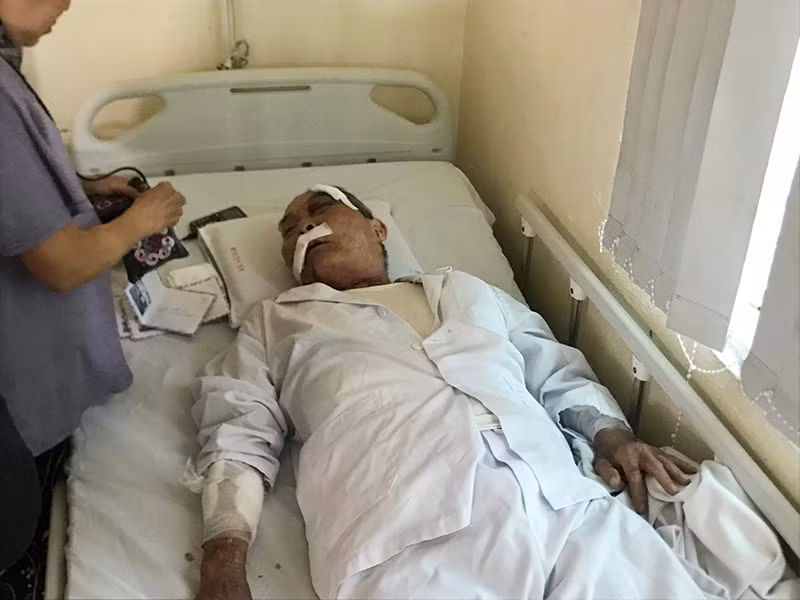 Cu ong 80 ngay thu 2 di lam xe om bi danh gay xuong ke lai phut kinh hoang