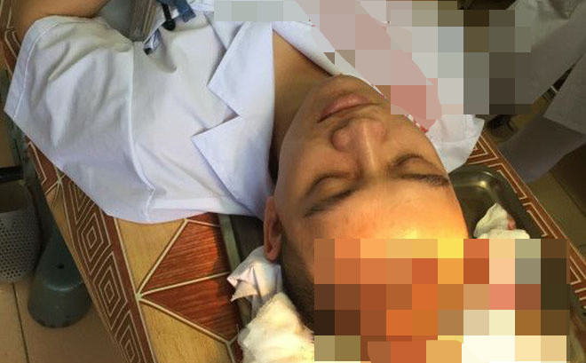  Cha bệnh nhi đánh bác sĩ chấn thương sọ não: Khoảng 23h30 ngày 8/4/2018, khi bác sĩ Nguyễn Đình Phi (SN 1990, khoa Nhi, Bệnh viện Đa khoa Hà Tĩnh) tiếp nhận bệnh nhân Nguyễn Phúc Đạt (14 tháng tuổi) trong tình trạng sốt cao 39,6 độ và đã được đặt thuốc hạ nhiệt hậu môn tại khoa Cấp cứu Chống độc. 