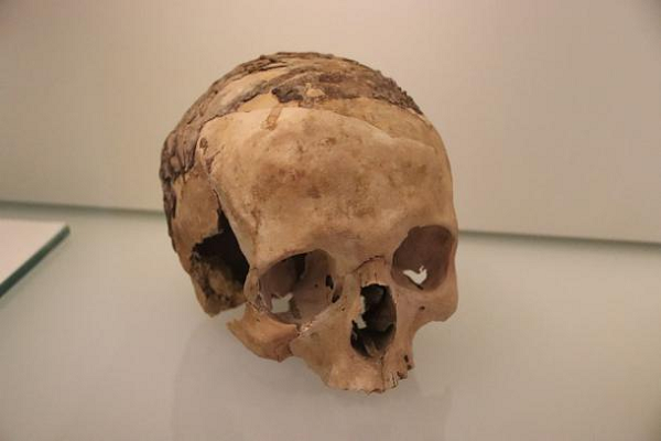 "Có vẻ một lớp nhựa đường mỏng đã được chà lên mặt sau những hộp sọ này, sau đó những sợi dây nhựa đường được chuẩn bị sẵn sẽ phủ lên trên lớp đầu tiên, tạo nên hình dạng một tấm lưới - có thể là một chiếc mũ cho người chết", Cơ quan Quản lý cổ vật Israel (IAA) cho biết.