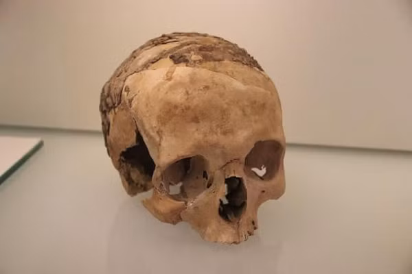 "Có vẻ một lớp nhựa đường mỏng đã được chà lên mặt sau những hộp sọ này, sau đó những sợi dây nhựa đường được chuẩn bị sẵn sẽ phủ lên trên lớp đầu tiên, tạo nên hình dạng một tấm lưới - có thể là một chiếc mũ cho người chết", Cơ quan Quản lý cổ vật Israel (IAA) cho biết.