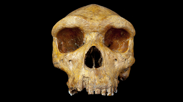 Nó thu hút sự quan tâm của cả thế giới không phải vì nguồn gốc mà vì chiếc lỗ nhỏ, tròn một cách hoàn hảo ở phía bên trái của hộp sọ và một tấm xương đỉnh sọ bị vỡ ở phía đối diện.