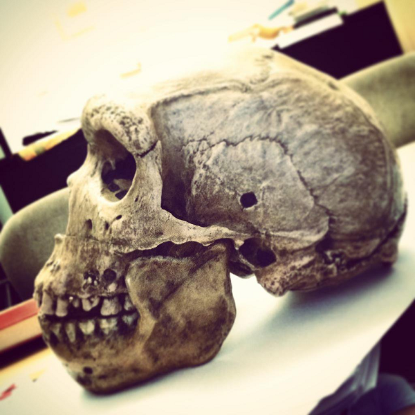 Theo đó, cách Kabwe, Zambia hàng nghìn km, dọc theo sông Lena ở Nga, một hộp sọ cổ khác cũng được phát hiện với cùng một lỗ thủng tròn nhỏ hoàn hảo.