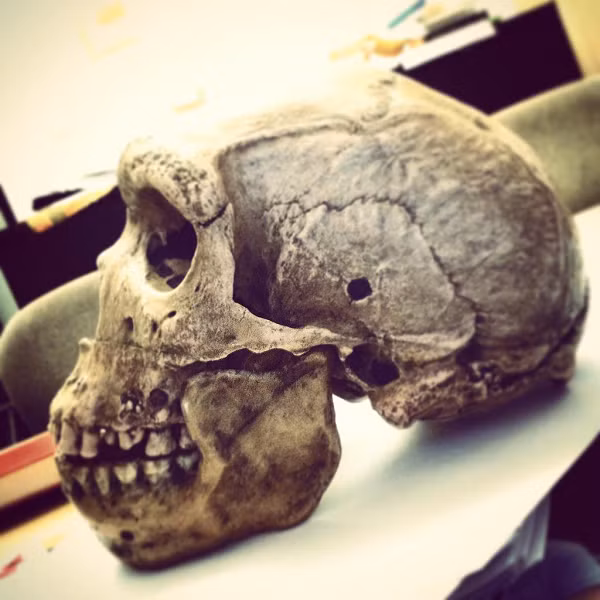 Theo đó, cách Kabwe, Zambia hàng nghìn km, dọc theo sông Lena ở Nga, một hộp sọ cổ khác cũng được phát hiện với cùng một lỗ thủng tròn nhỏ hoàn hảo.