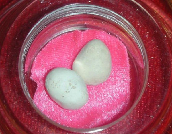 Vậy tại sao người bình thường không có xá lợi? Chúng ta có thể trả lời bằng cách hỏi ngược lại: Vậy tại sao không phải cao tăng nào cũng có xá lợi? Câu trả lời là nếu nhiệt độ hỏa táng ban đầu khoảng 600 độ C, sau đó tăng lên 1.00 độ C, nhiều khả năng các khối tinh thể sẽ xuất hiện, miễn là nhiệt độ không quá cao.