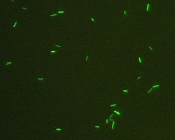 Mặc dù nhìn tương đồng với vi khuẩn, vi khuẩn cổ vẫn mang bộ gen và một số con đường trao đổi chất gần với sinh vật nhân chuẩn hơn: đặc biệt các enzyme liên quan tới quá trình phiên mã và dịch mã.