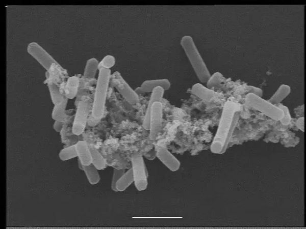 Vi khuẩn và vi khuẩn cổ khá tương đồng về hình dạng và kích thước, dù một vài vi khuẩn cổ có hình dạng bất thường, như tế bào dạng phẳng và vuông của Haloquadra walsbyi.