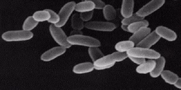 Trong quá khứ, chúng được xem như một nhóm vi khuẩn khác biệt và được gọi là vi khuẩn cổ (danh pháp khoa học: Archaebacteria), nhưng do có lịch sử tiến hóa độc lập và nhiều bất đồng về sinh hóa với các dạng khác của sự sống, chúng hiện được phân thành một vực (domain) riêng trong hệ thống ba vực.