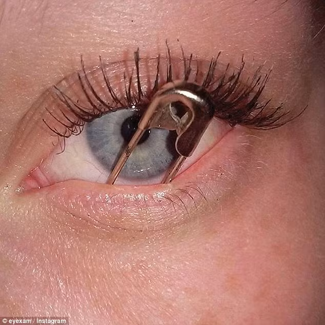 Bức ảnh nhét kim băng vào trong hốc mắt này thu hút được 4.600 người bình luận trên mạng Instagram.