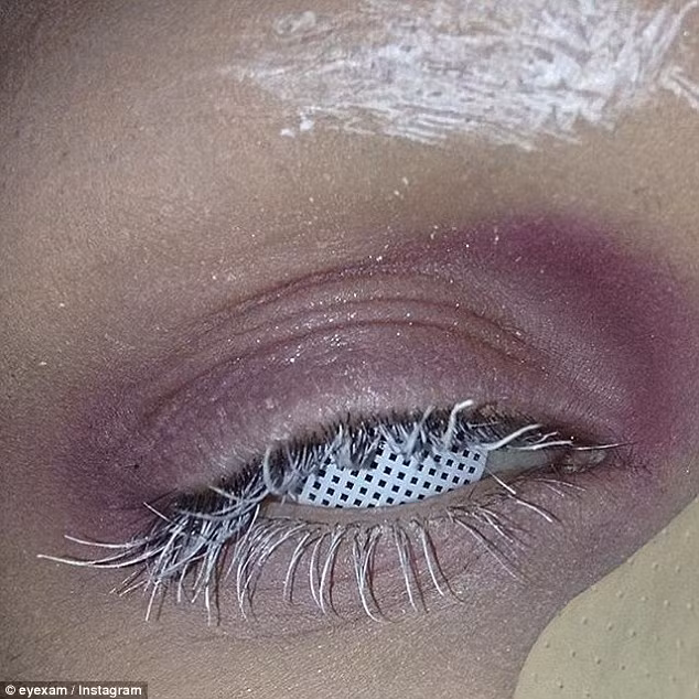 Một người thậm chỉ còn nhét cả một vật hình lưới vào mắt như thế này.