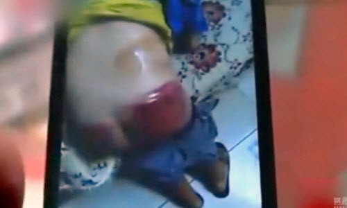 Thầy giáo dùng chổi đánh tím mông học trò gây phẫn nộ Thay giao dung choi danh tim mong hoc tro gay phan no