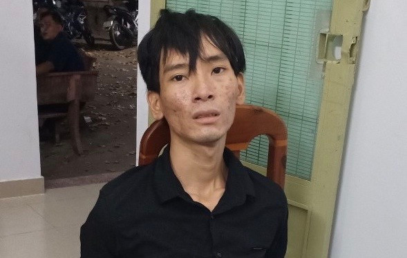 Vo hoi duong nhung van khong thoat “nghiep vu” canh sat-Hinh-2