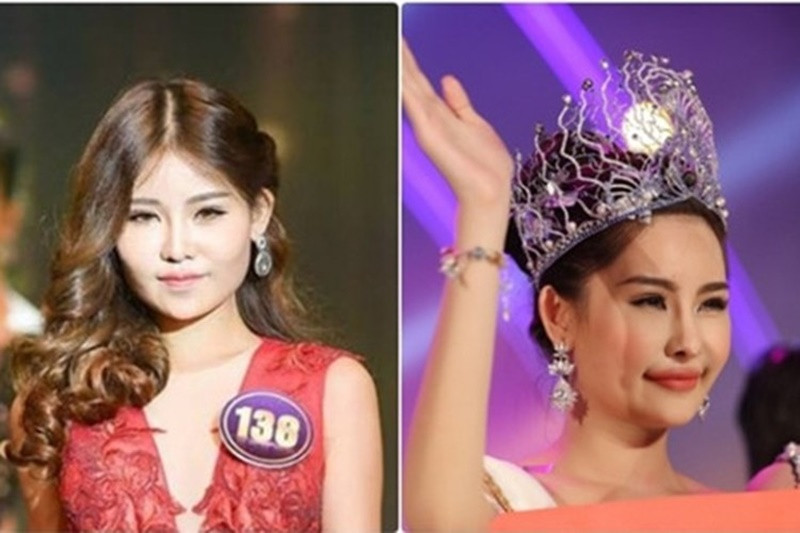 Giữa ồn ào, Ngân Anh thừa nhận cô từng sửa mũi nhưng khi tham gia Hoa hậu Đại dương 2017, cô đã tháo sụn mũi, trả lại nguyên trạng. Ngân Anh khẳng định gương mặt của cô hiện tại hoàn toàn tự nhiên. Tuy nhiên, lời giải thích này không làm hài lòng số đông cư dân mạng. Ảnh: Dân Việt.