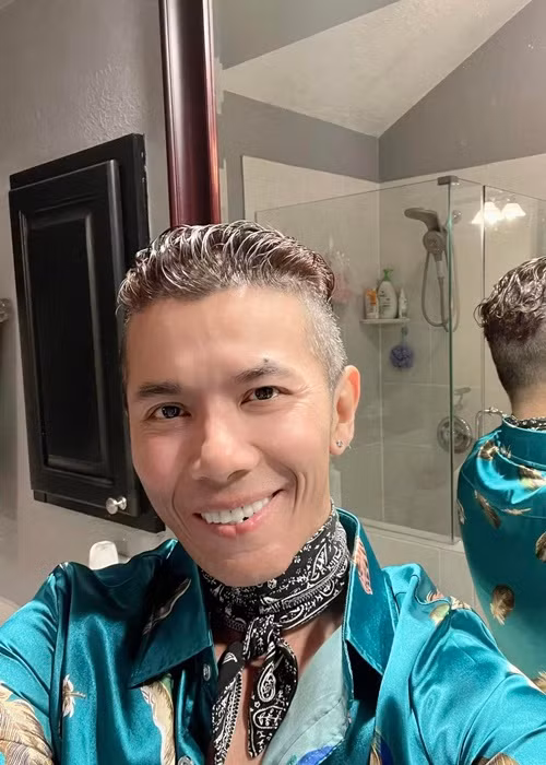 Nam ca sĩ ăn ít hơn trước và chỉ ăn đồ mềm sau ca phẫu thuật nên cơ hàm không hoạt động nhiều khiến gương mặt trở nên gầy.