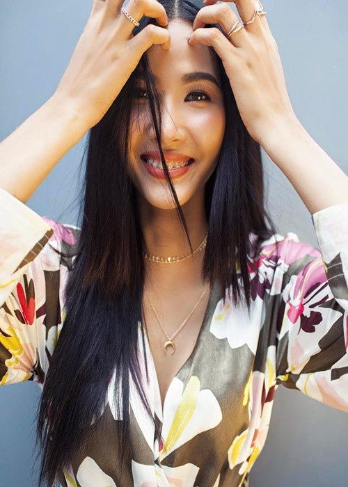 Người đẹp đeo niềng răng trong suốt 2 năm sau khi giành danh hiệu Á hậu 1 Hoa hậu Hoàn vũ Việt Nam 2017. Ảnh: Khám Phá.