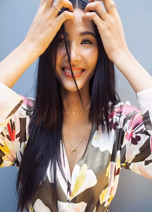 Người đẹp đeo niềng răng trong suốt 2 năm sau khi giành danh hiệu Á hậu 1 Hoa hậu Hoàn vũ Việt Nam 2017. Ảnh: Khám Phá.