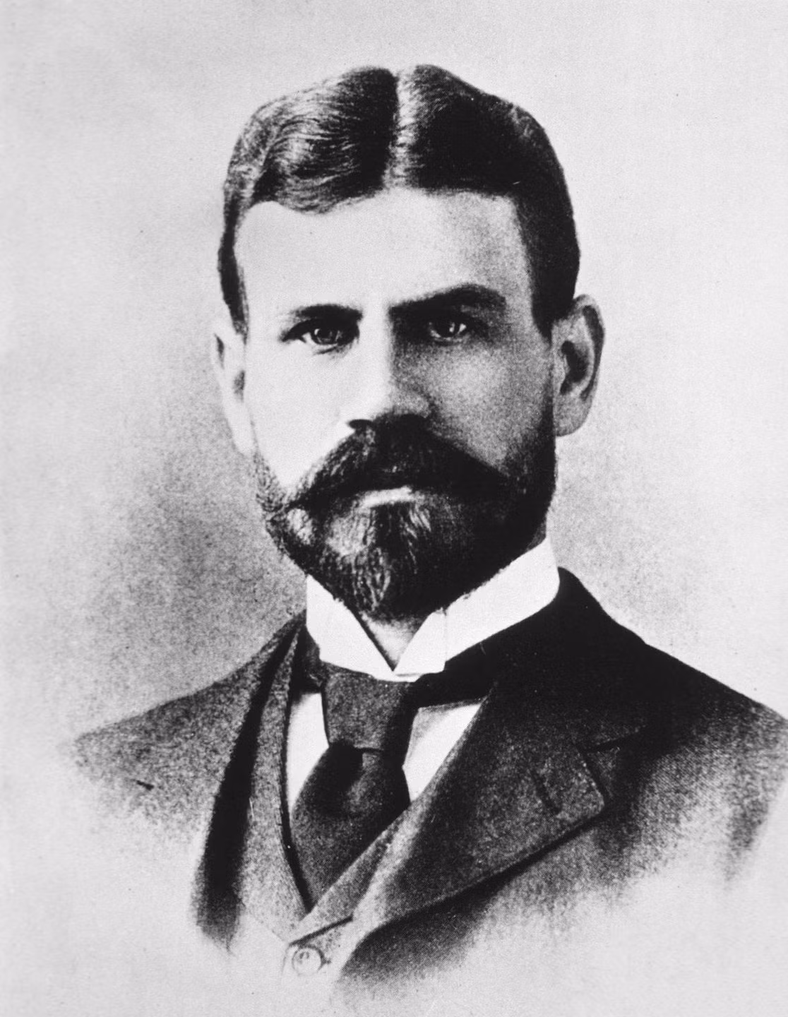 Vì vậy, bác sĩ Lazear tìm cách chứng minh mình nhận định của mình là chính xác. Ông đích thân tham gia thử nghiệm để cho muỗi nhiễm bệnh cắn vào người.