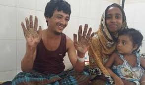 Mẹ của Bajandar nói về căn bệnh của con trai rằng đôi tay "của quỷ" khiến anh như sống trong "địa ngục".